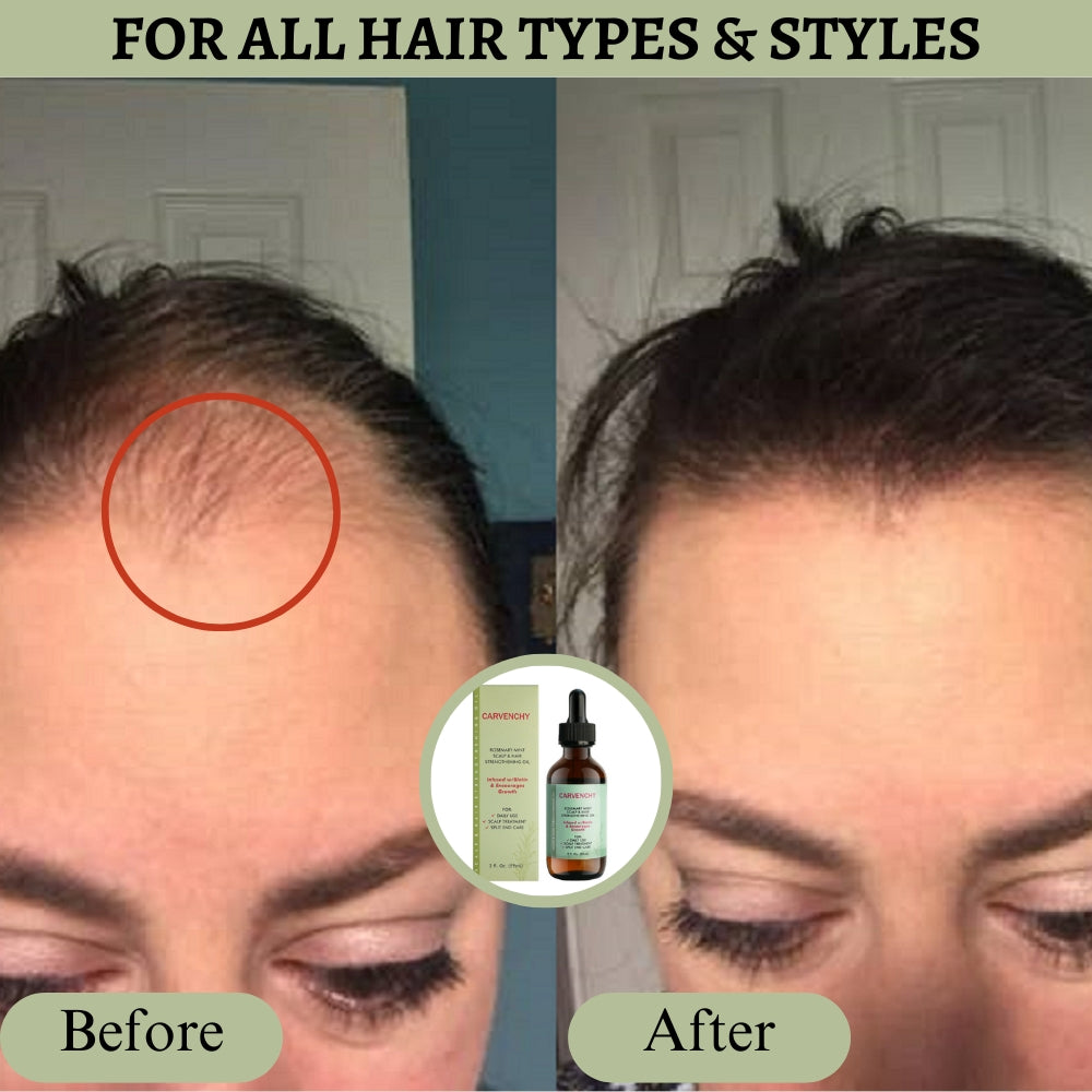 Rosemary Scent Version Anti-Hair Loss Growth Veganic Serum