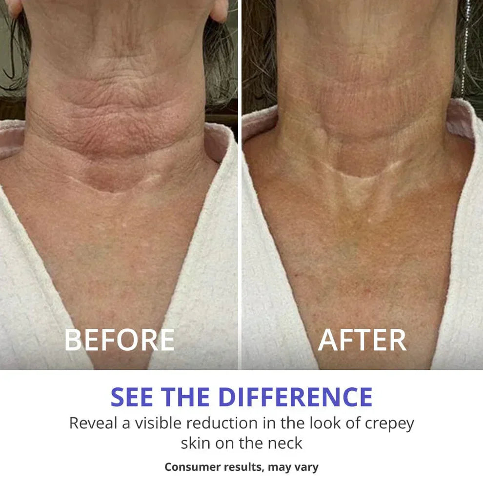 Carvenchy™ Tighten & Lift Neck Cream