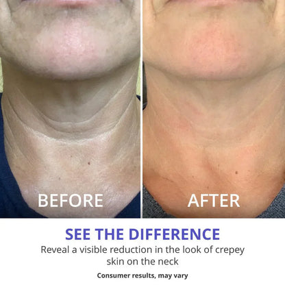 Carvenchy™ Tighten & Lift Neck Cream