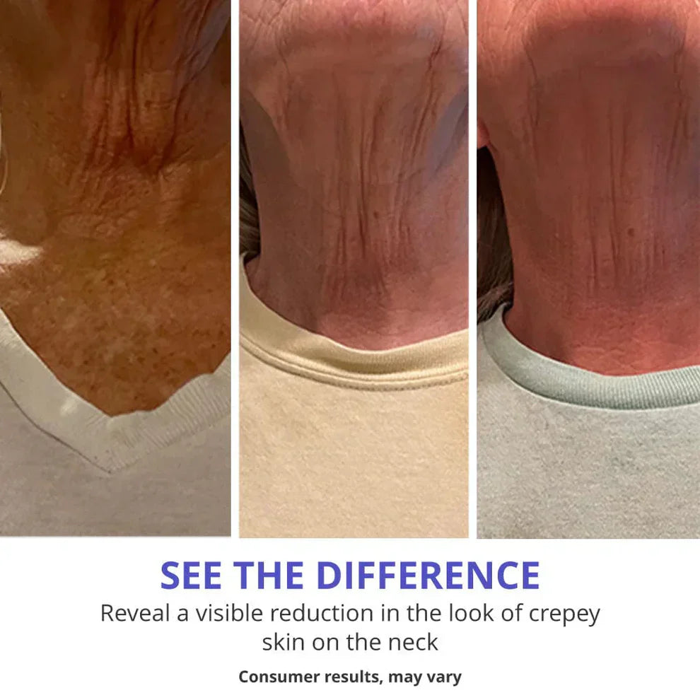 Carvenchy™ Tighten & Lift Neck Cream