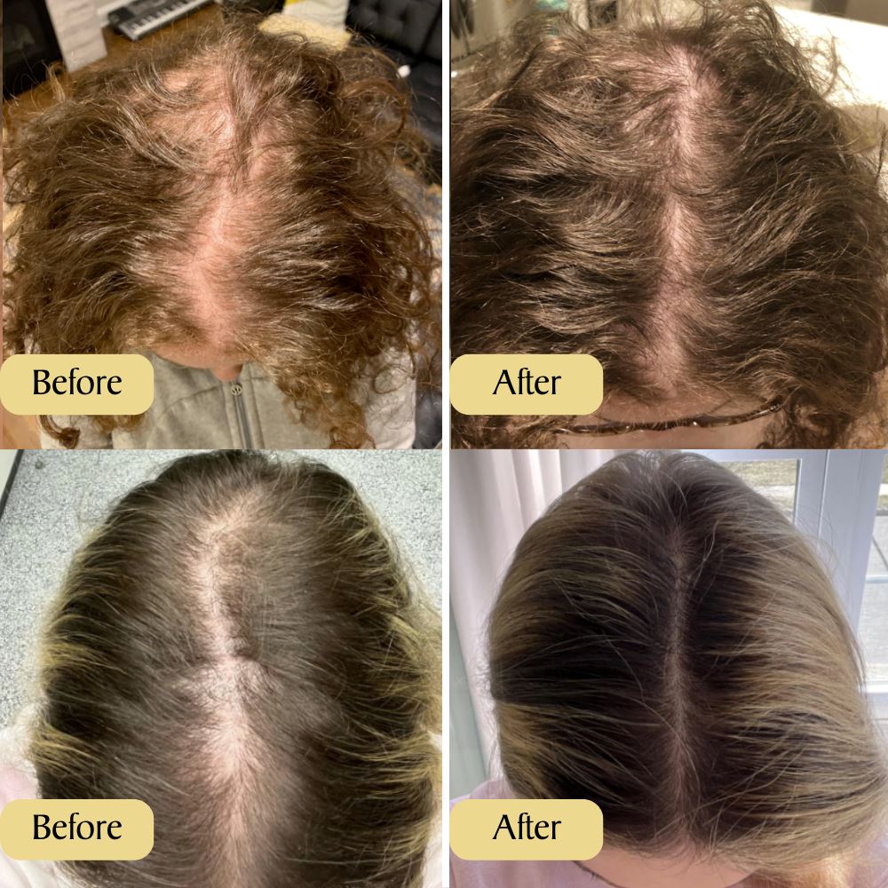 Red Onion And Coconut Oil For Hair Growth - Instagram